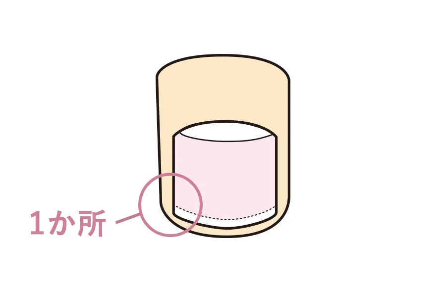 巻き爪1か所の数え方