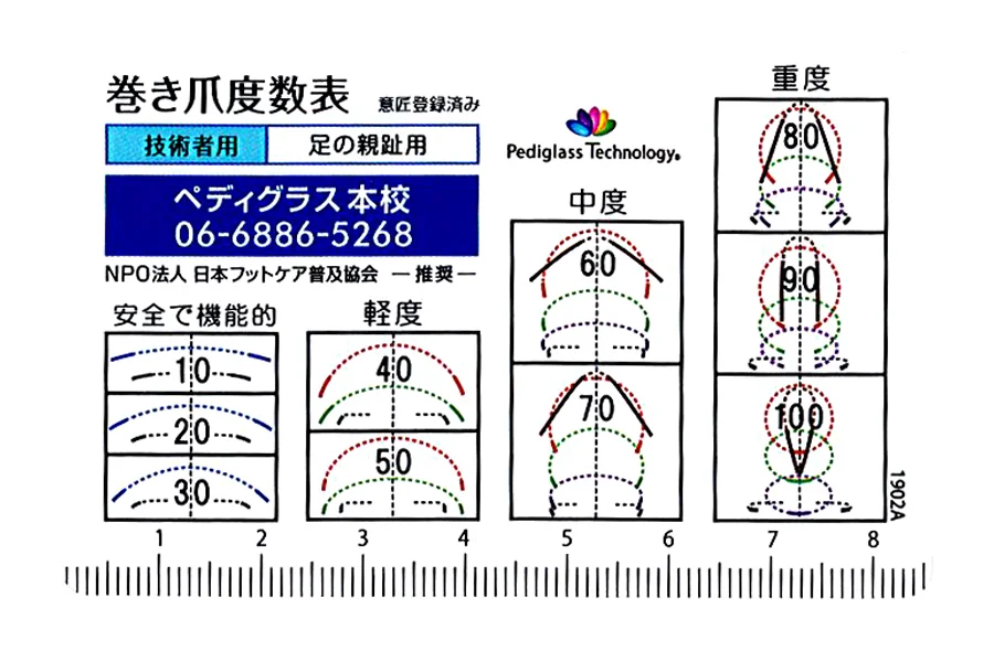 巻き爪度数表