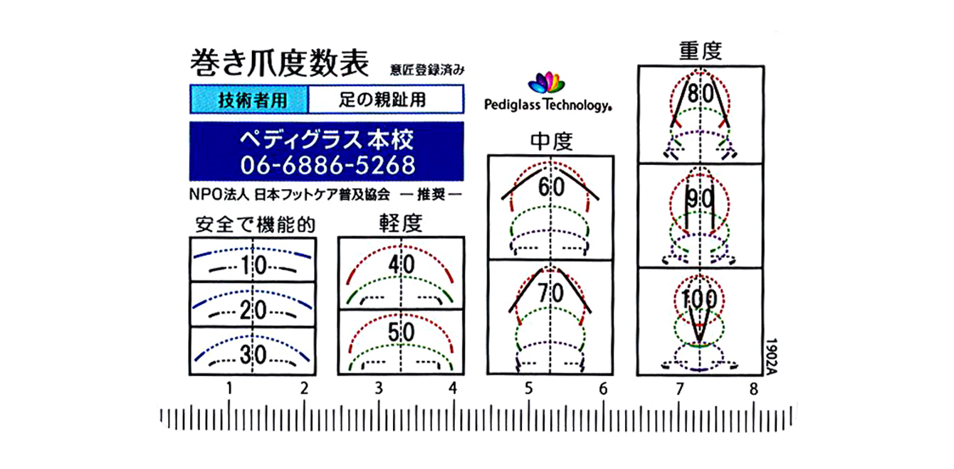 巻き爪度数の測り方