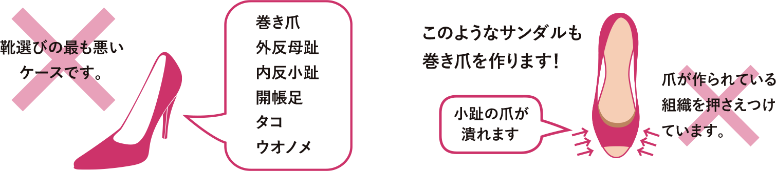 正しい靴選び