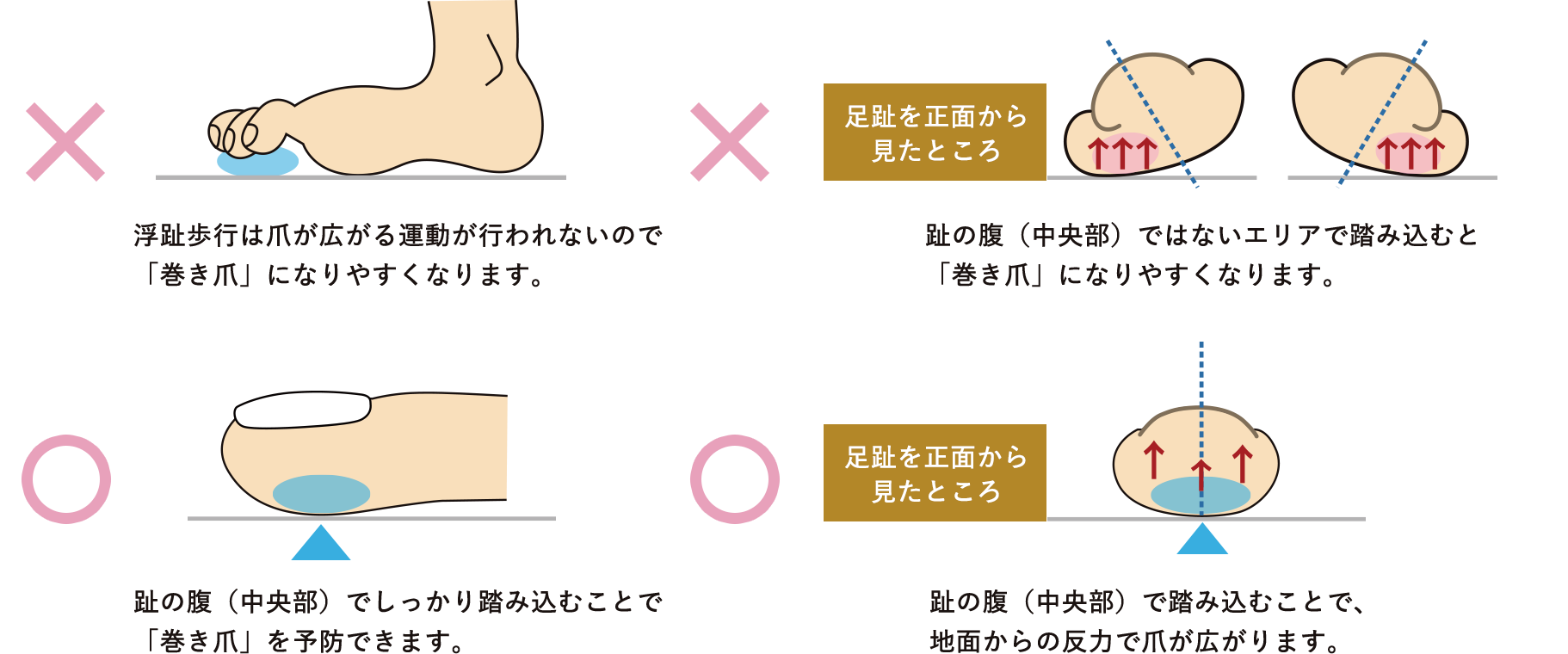 趾を使わない歩行