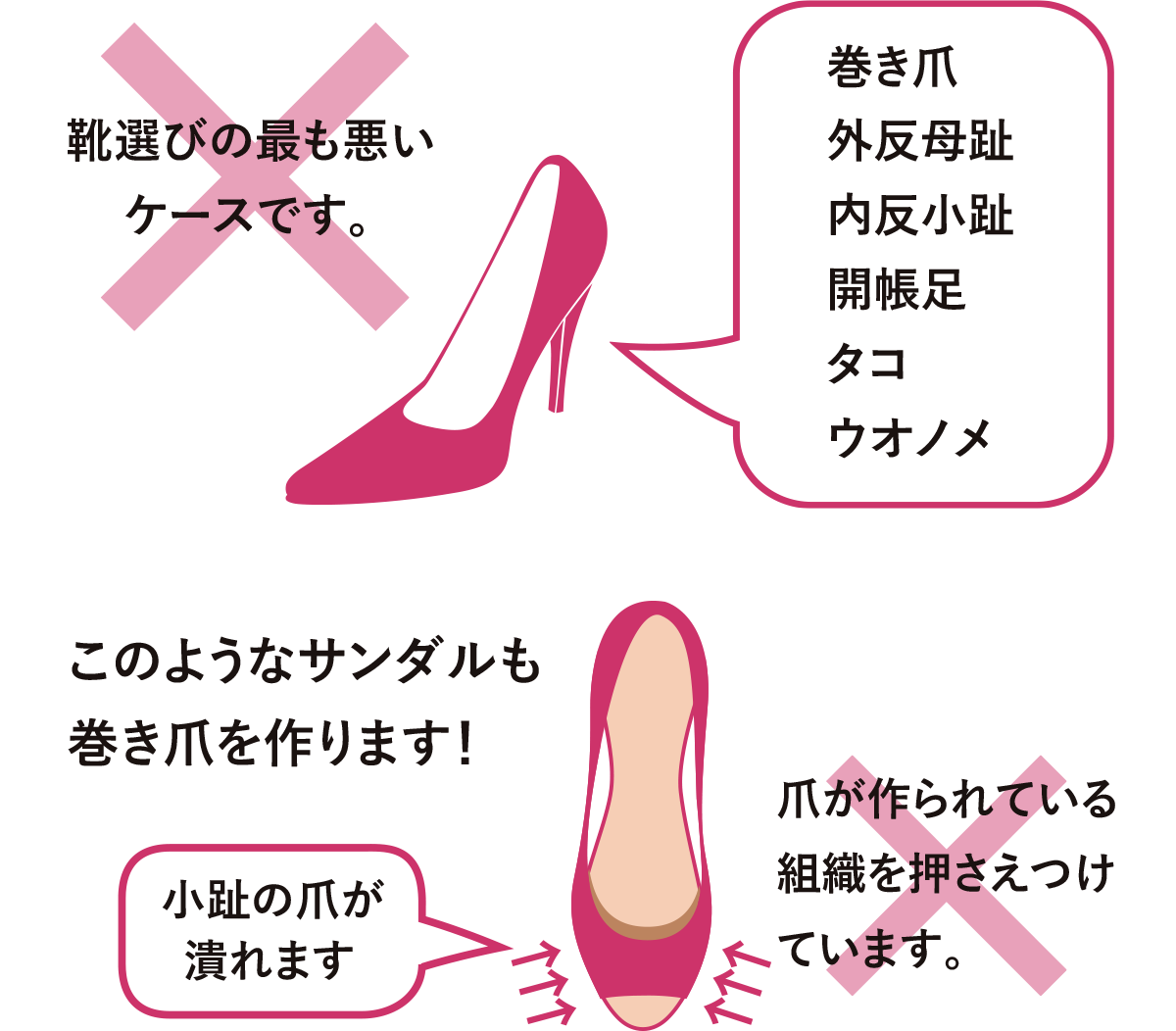 正しい靴選び