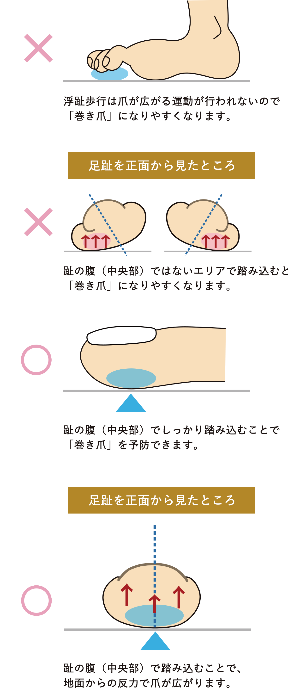 趾を使わない歩行